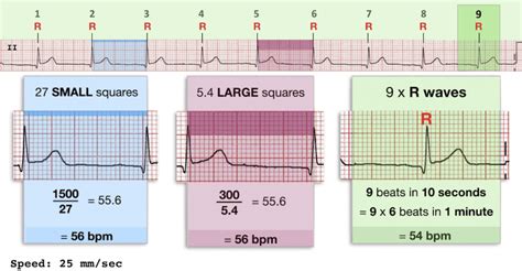 ecg exam template